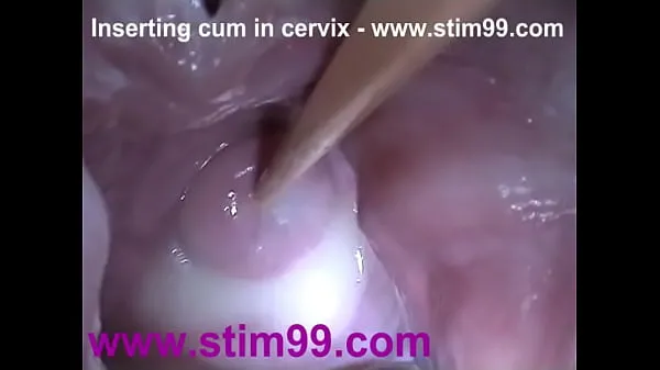 Yeni Insertion Semen Cum in Cervix Wide Stretching Pussy Speculumen iyi videolar